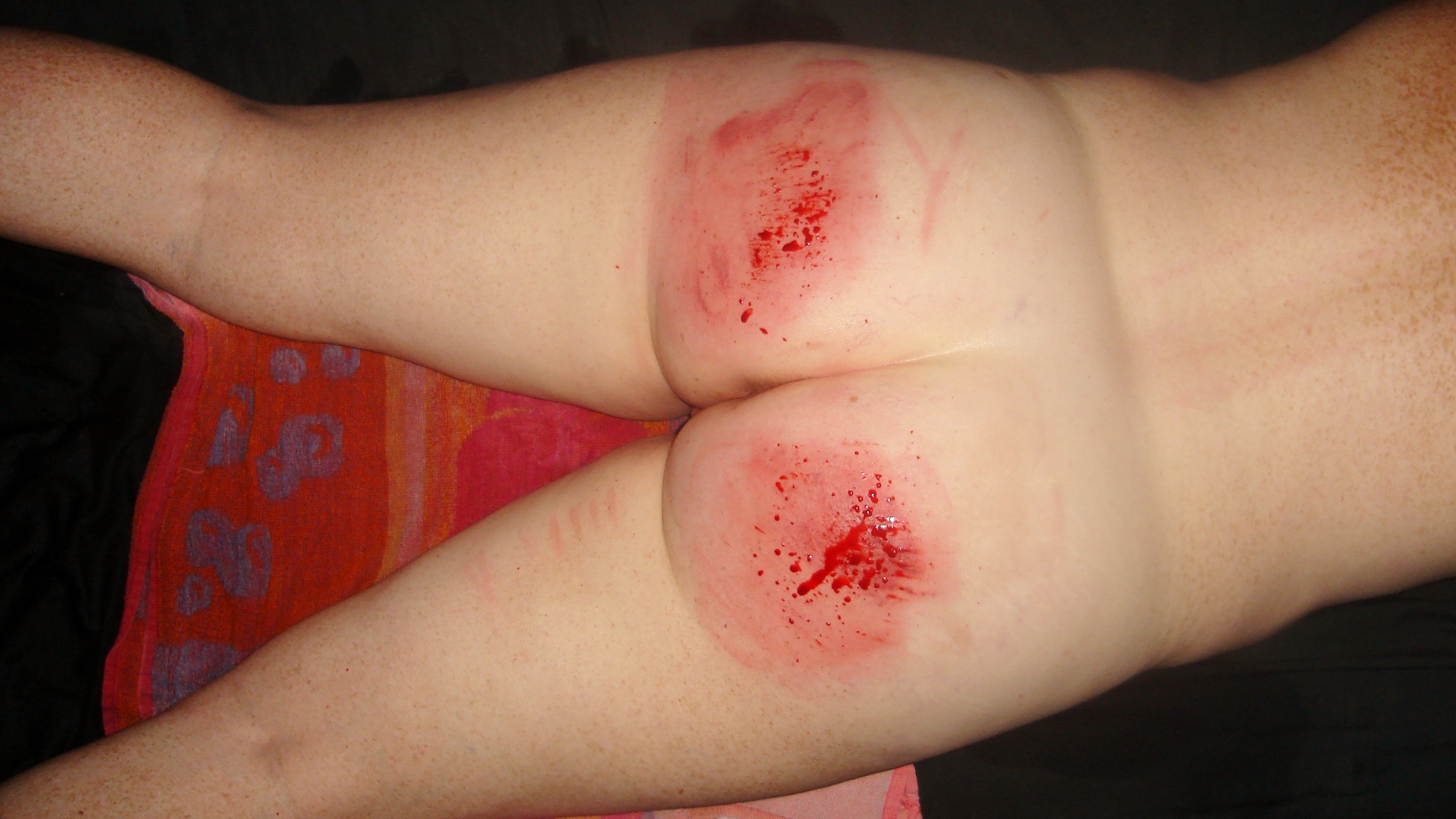 Cutting BBW Slave's Bleeding Ass and Bloody Tits — 30