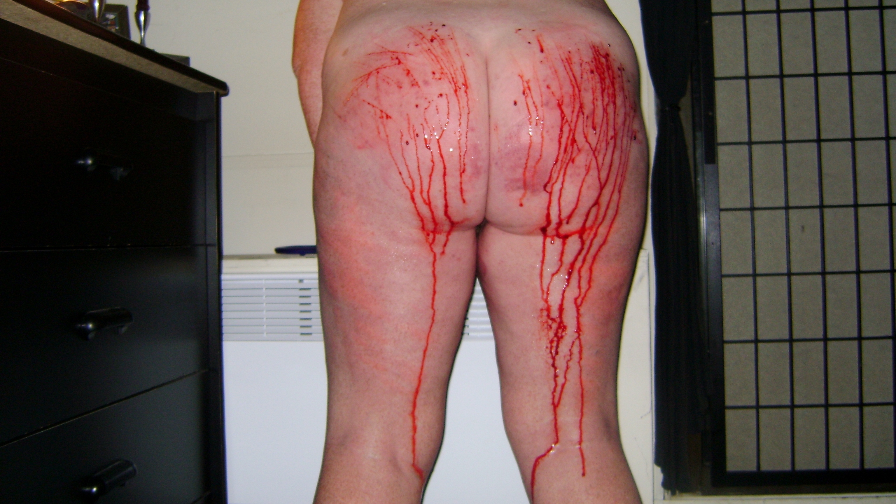 Cutting BBW Slave's Bleeding Ass and Bloody Tits — 5